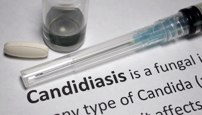 candidiasis definition on paper