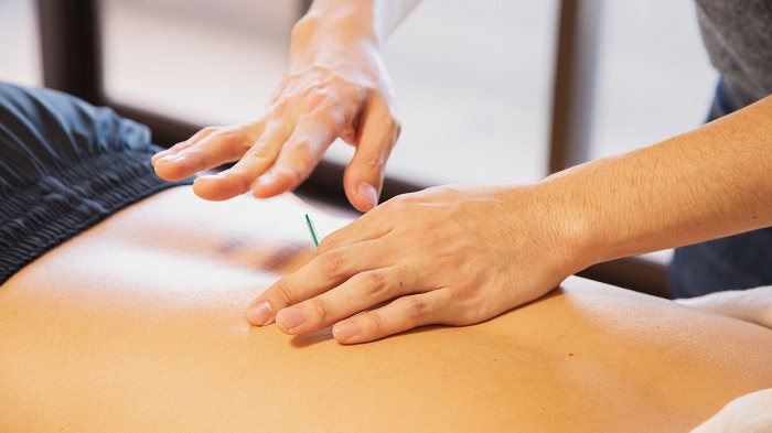 acupuncturists placing needle in client's back